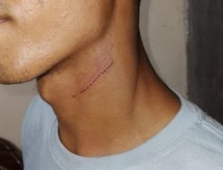 Nyaris Tergorok Leher ” Korban Lapor Di Polres Lampung Utara